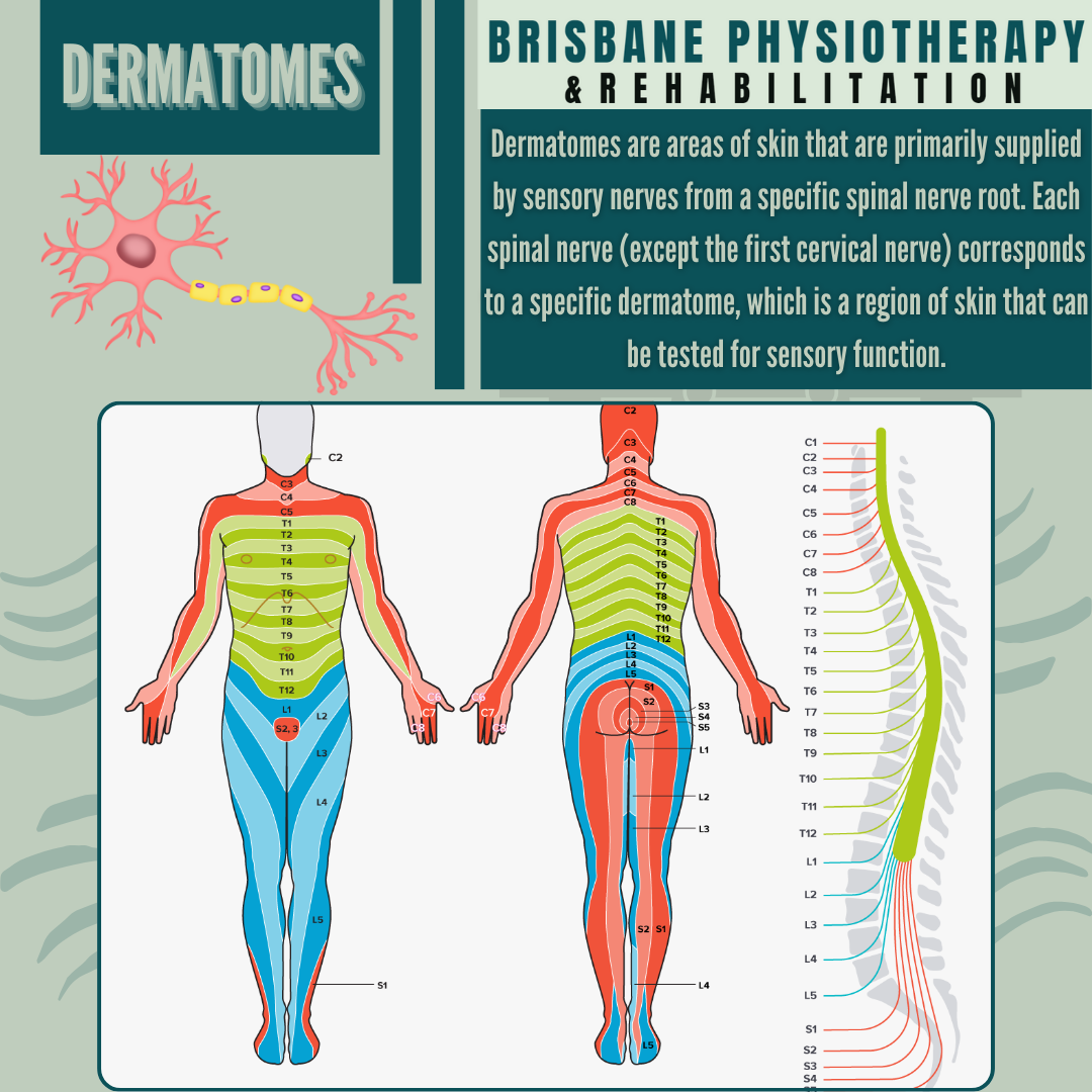 Dermatomes An Overview Brisbane Physiotherapy U0026 Podiatry