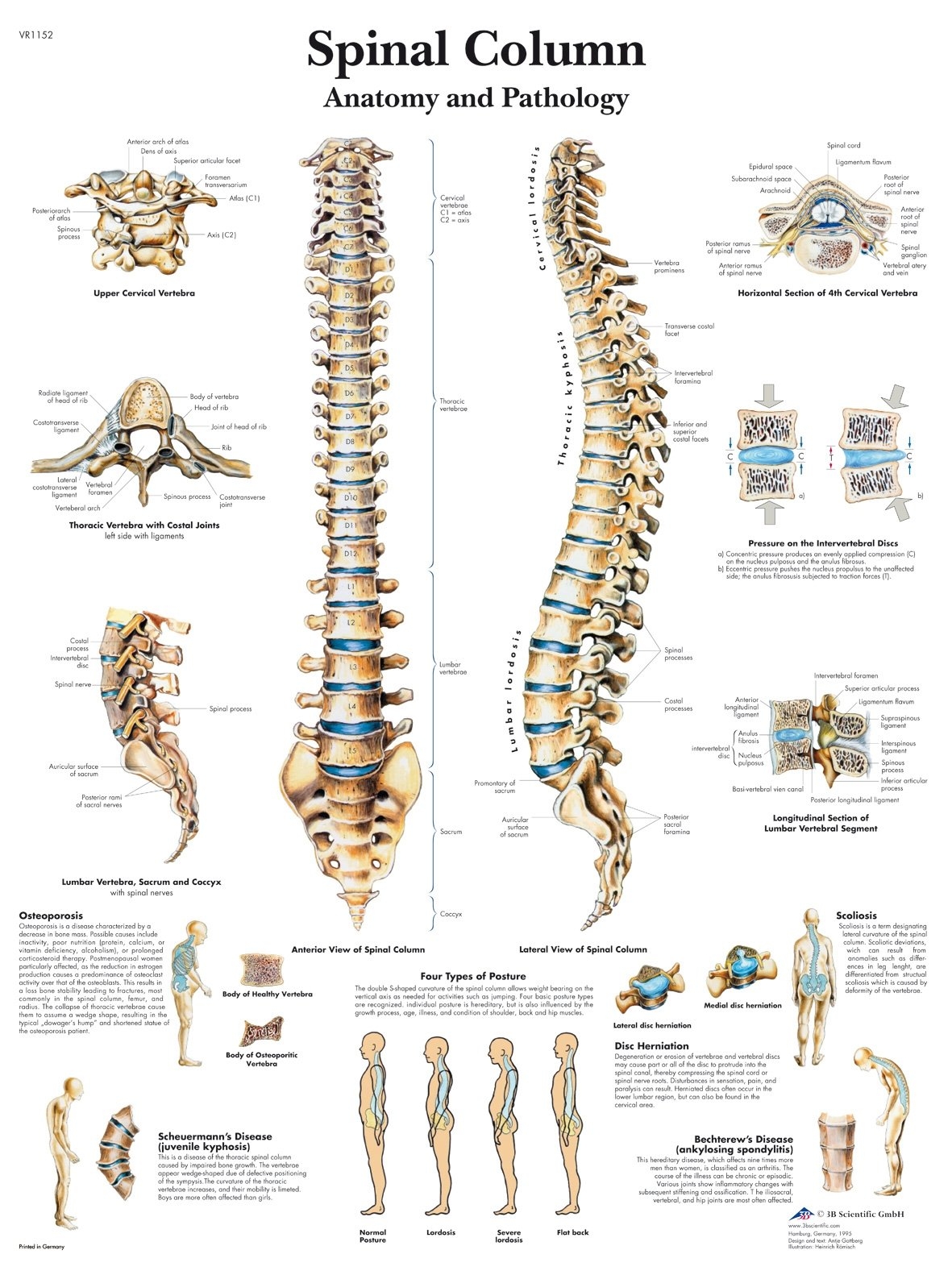 Spinal Column Chart